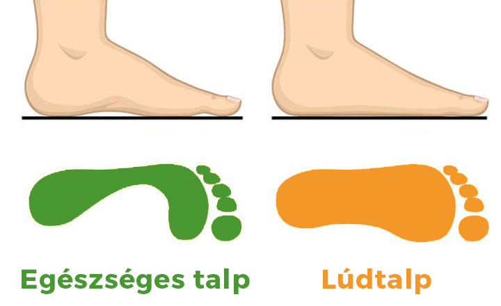 láb és gerinc kezelés)